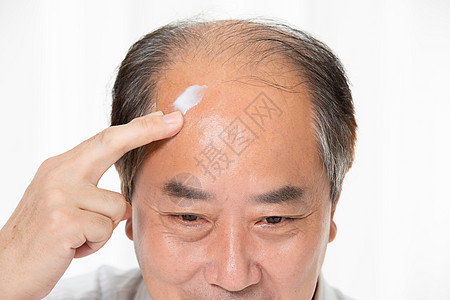 无奈秃头中年男性用增发膏背景