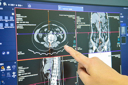 医疗ct监控高清图片