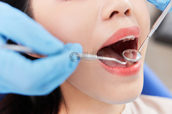 女性患者做牙齿手术特写图片