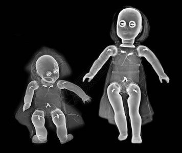 两个娃娃的X光图片