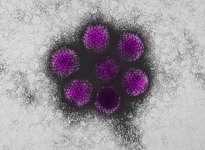 感染犬肝炎的电子显微仪图片