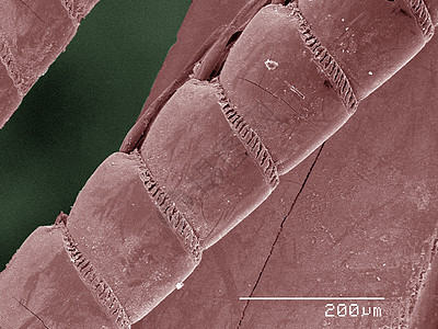 曼蒂德虾天线彩色SEM图片