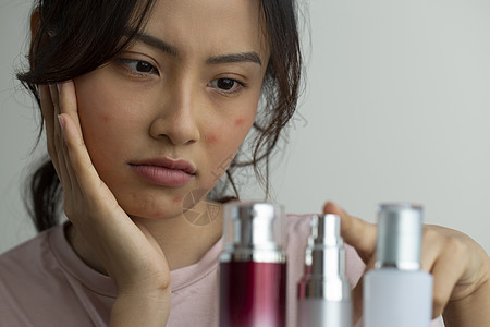 外国人泛亚洲年轻女子女患皮肤粗糙图片