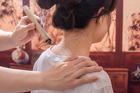 传统中医艾灸疗法图片