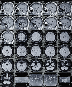 磁共振脑断层扫描背景图片