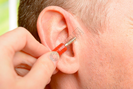 耳针疗法或耳针疗法或耳针疗法或耳针疗法是基于耳朵是反映整个身体的微系统这一思想的图片