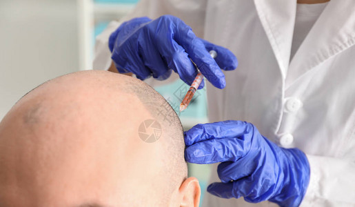 在诊所注射时有头发病问题的男子在背景图片