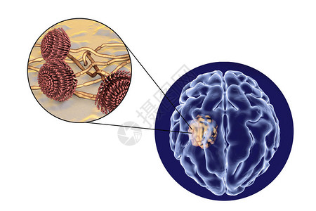 脑曲霉菌和真菌曲霉菌的特写视图图片