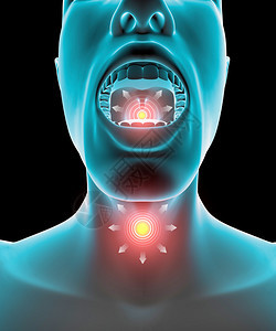灼热喉咙痛张嘴和喉咙图片