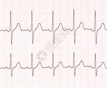 背景网格上的心电图背景图片