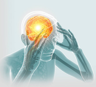 中年人疼男感觉头痛的3d插图设计图片