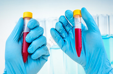 科学家手握一个带有血液样本的试管用于B图片