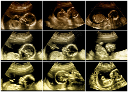 系列9幅胎儿超声图像图片