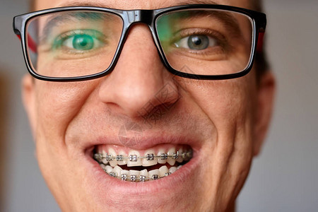 带着微笑和眼镜的牙套的家伙的疯狂脸蛋背景图片