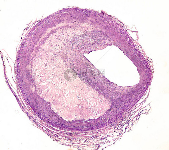 一根动脉的十字截面图片