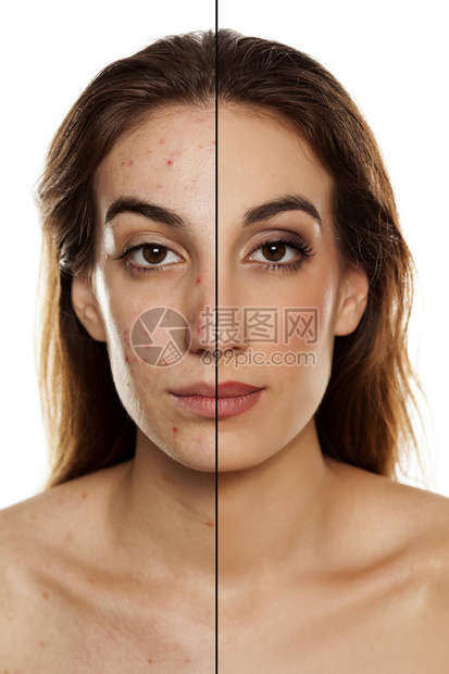 化妆品治疗前后同一位妇女比较肖像和白底妆色的对比图画图片