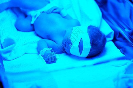 两天大的新生婴儿在蓝色紫外光背景图片