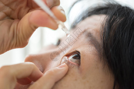 亚洲女使用滴眼液或人工泪液滴入眼部治疗眼球的炎症或干涩问题以图片
