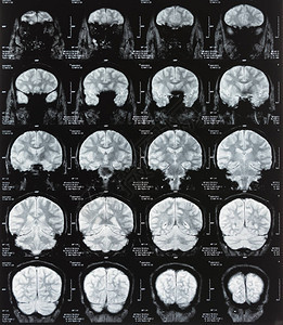 磁共振成像与大脑的ct扫描背景图片