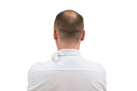 人类脱发或脱发成年男秃头秃头男人从孤立的白色背景图片