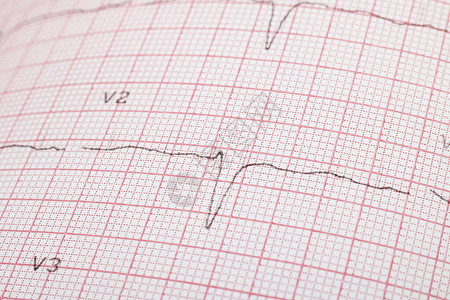 粉红纸上的心电图线关图片