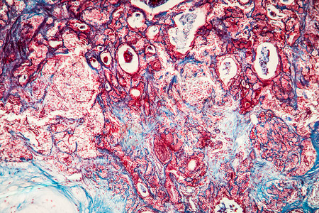 100x疾病组织图片