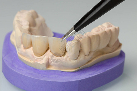 在牙科劳工中缝制假牙部分图片
