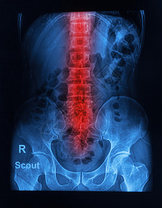 人的脊柱x射线图像图片