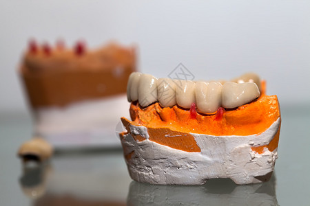 牙医店的锆瓷牙盘图片