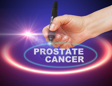 以2d软件在梯度背景上加标记的PROSTATE图片