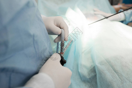 医生和辅助医疗团队在手术室对病人进行手术腹腔镜检查仪器在医院或诊所进行手术的外科医生医背景图片