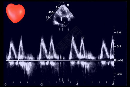 超声波图像和小心脏回声心动机屏幕背景图片