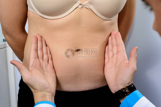 医生的手贴在病人胃上在抽脂前进行透血检图片