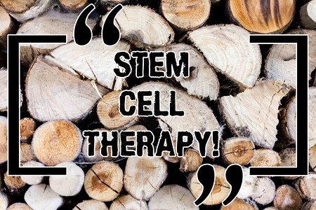 显示干细胞疗法的书写笔记商业照片展示使用它们来治疗或预防疾病或硬病木制背景复古木材野生信息图片