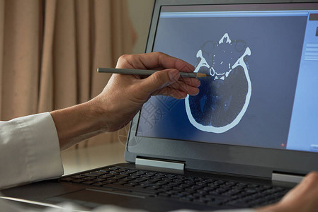 医生用铅笔演示人体大脑在医务室笔记本屏幕上进行自背景图片