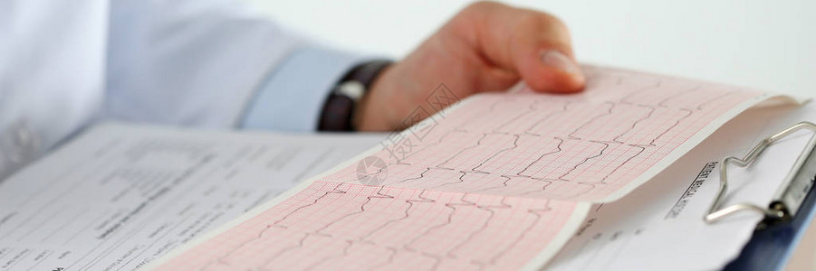 男医学生手拿着剪贴板垫特写上的心电图表图片