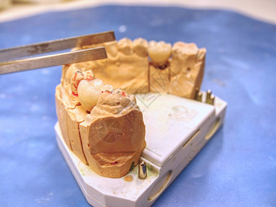 假肢实验室的牙科铸造石膏模型下巴牙科矫形术图片