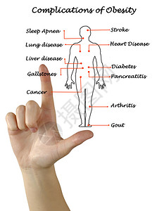 肥胖并发症图图片