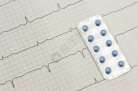 心电图和心脏药物图片