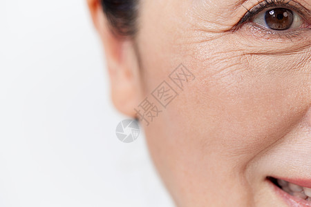 中年女性眼角细纹特写图片