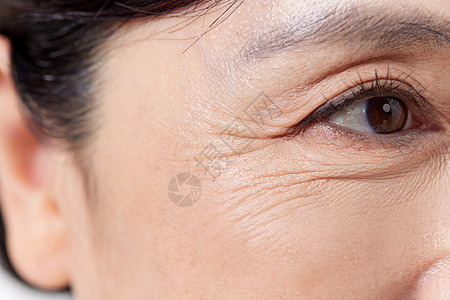 老年护理中年女性眼部特写背景