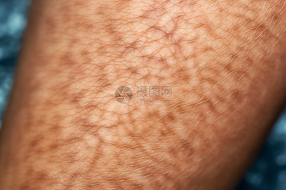 人腿上的干性皮肤特写图片