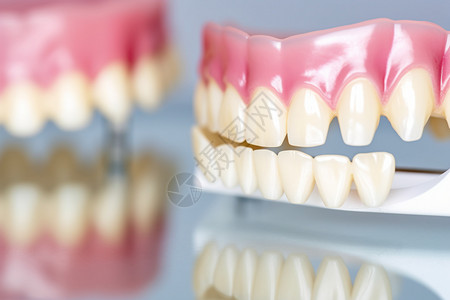 牙科诊所假牙贴面高清图片