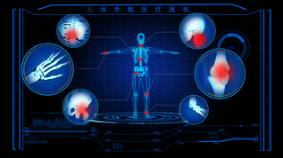 4Ｋ人体骨骼病症演示模板视频素材
