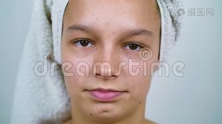 头戴浴巾、皮肤有问题的少女画像mov格式视频下载_正版视频编号1506863-摄图网
