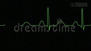 心电图检查.mov格式视频下载_正版视频编号1477894-摄图网
