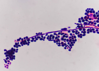 初露头角的酵母细胞结构图片