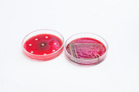 细菌培养皿图片