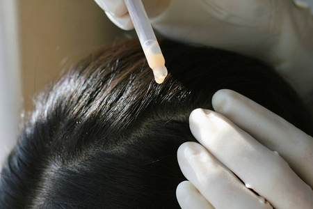 医生给予的待遇在患者的头发和头皮，近摄镜头的皮肤科医生考试头皮障碍