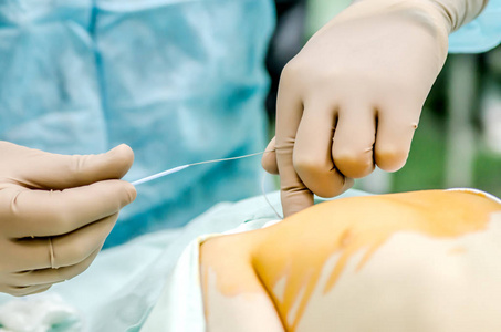 麻醉师在手术室内建立中心静脉导管